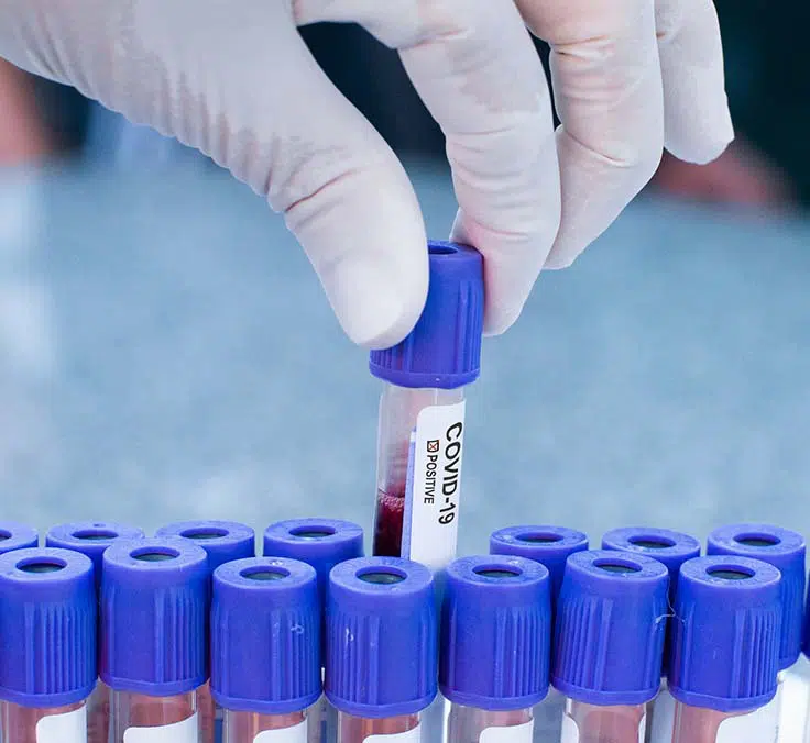 SAVIA y MADE OF GENES ofrecen a sus usuarios conocer sus anticuerpos ante el covid-19 y un análisis genético, además de otros servicios de salud