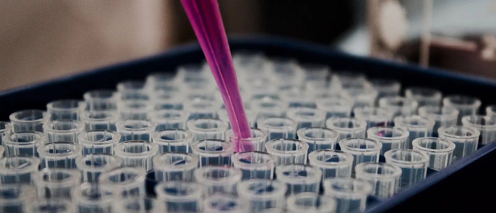 Mariano Esteban: “Hay que poner todos los medios clínicos para proteger a la población, que la infección se ralentice y el organismo consiga superarla”