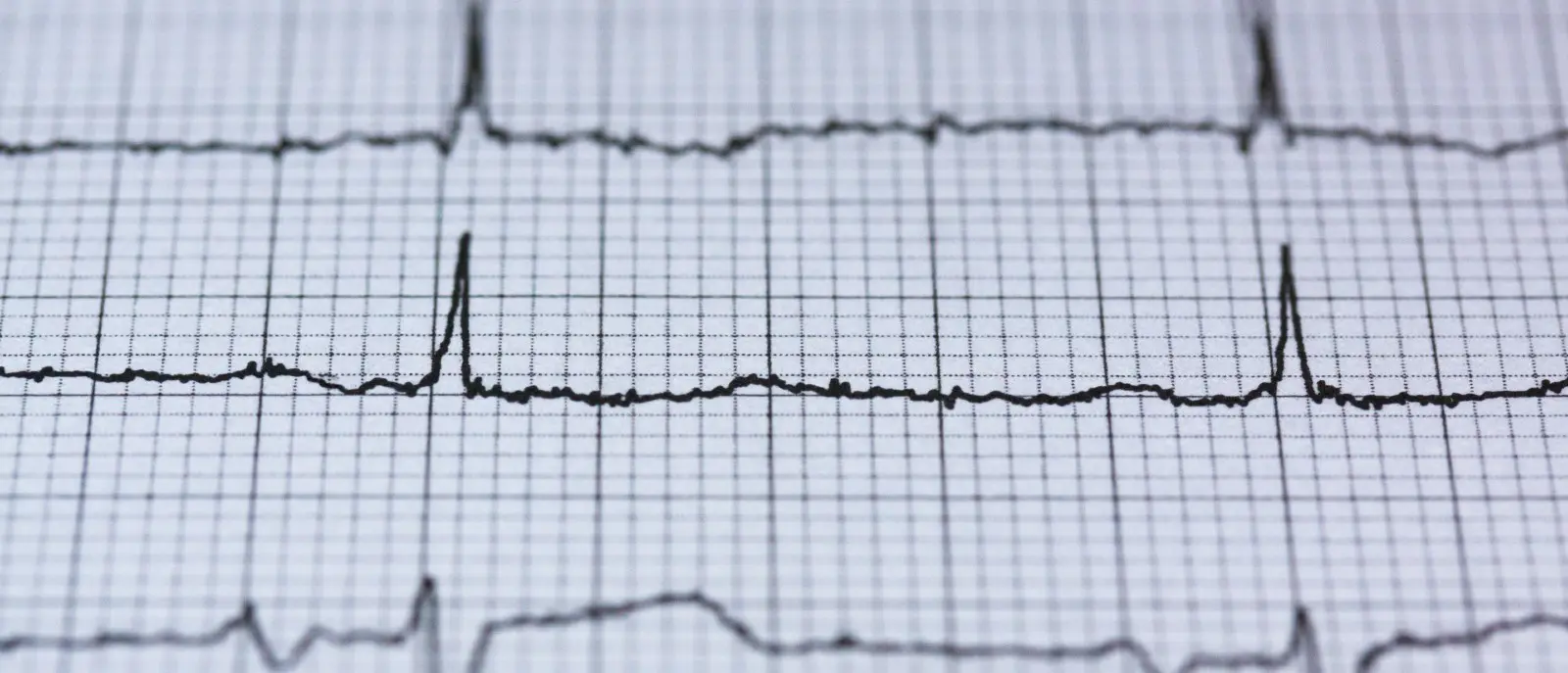 Entrevista a Javier González, ingeniero de materiales y fundador de The Open Ventilator
